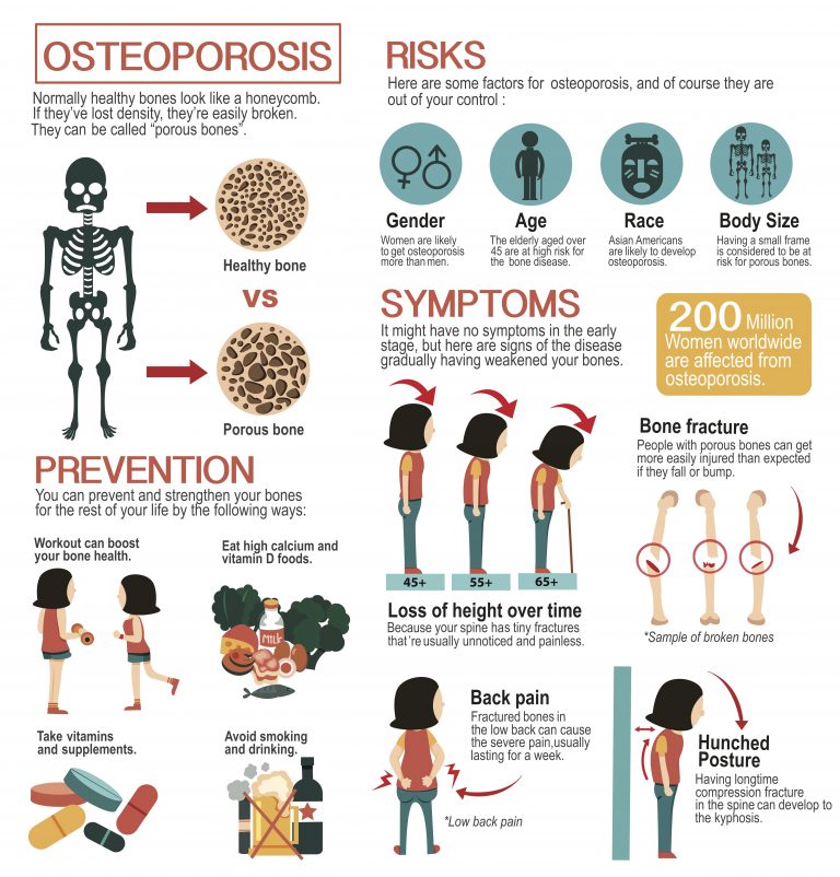 risk-factors-and-prevention-for-osteoporosis-dr-jess-md